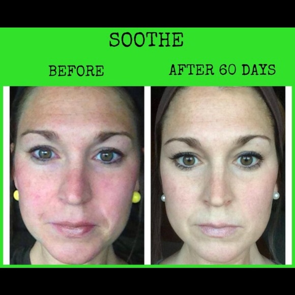 BRAND NEW Rodan and Fields “Soothe” Regimen - Picture 2 of 3